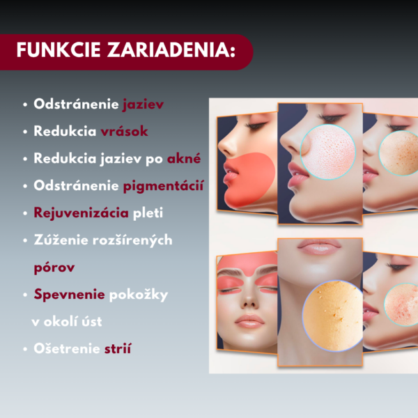 34 Erbiový laser 2940nm SH20 - na resurfacing, omladenie a obnovu pokožky
